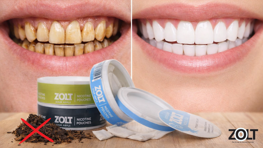 Best Tobacco-Free Pouches Do They Stain Your Teeth